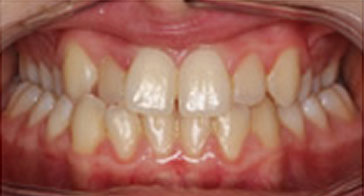 After Image 1