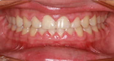 After Image 2
