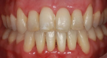 After Image 3