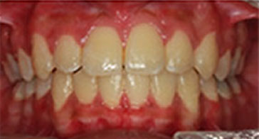After Image 4