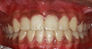 After Image 5