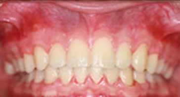 After Image 6