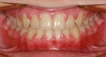 Before Image 1
