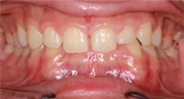 Before Image 2