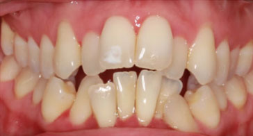 Before Image 3