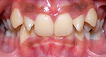 Before Image 4