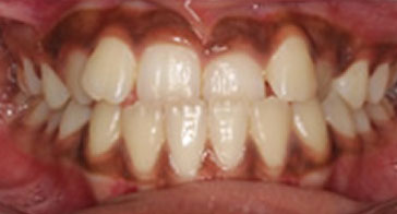 Before Image 5