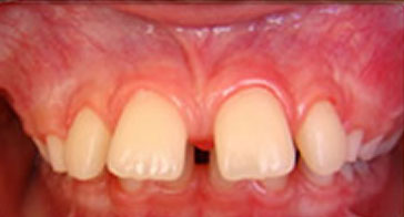 Before Image 6